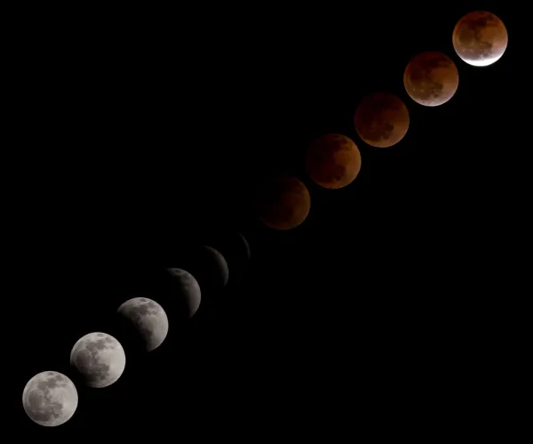Symptômes oculaires après l’éclipse : fatigue ou blessure ?